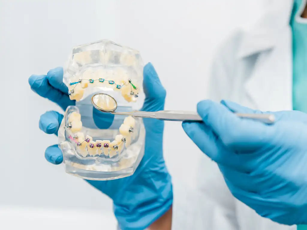Dental Crown Twinkle Family Dental Care