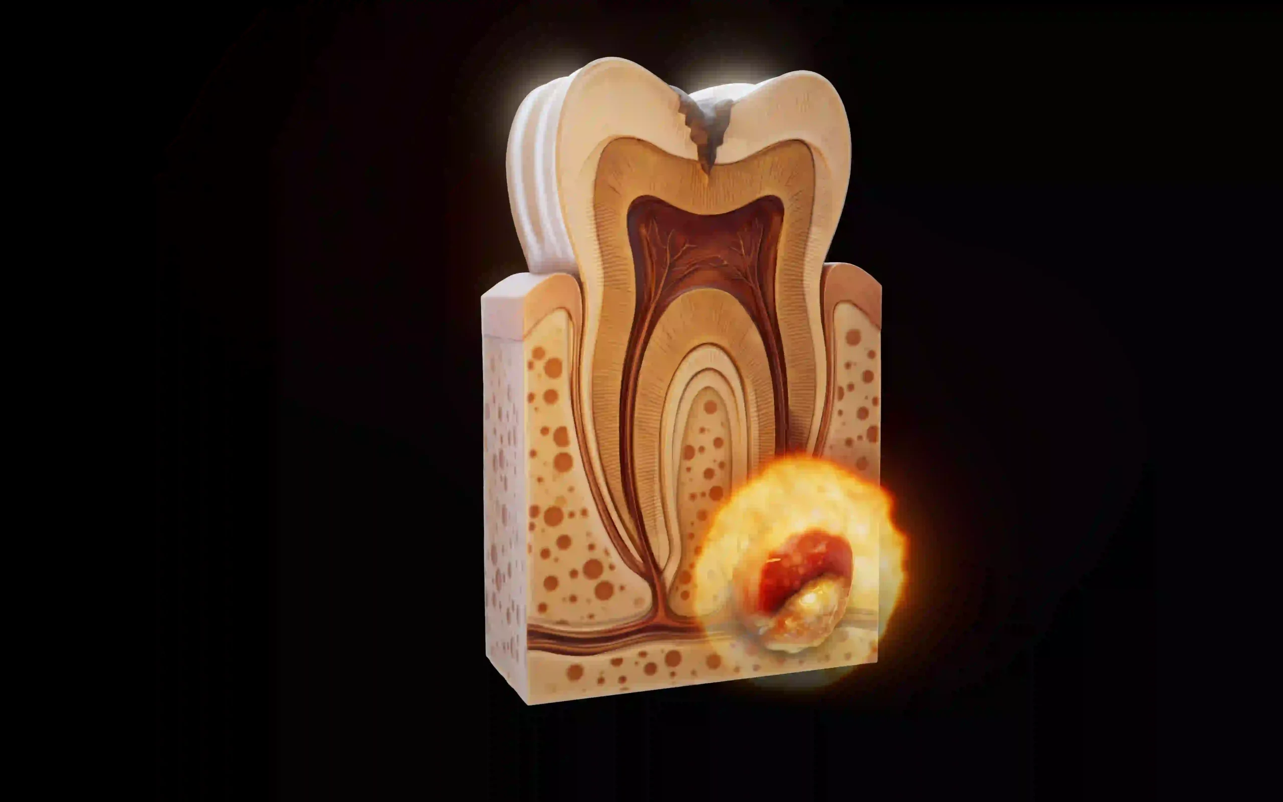 Dental Fluorosis Twinkle Family Dental Care