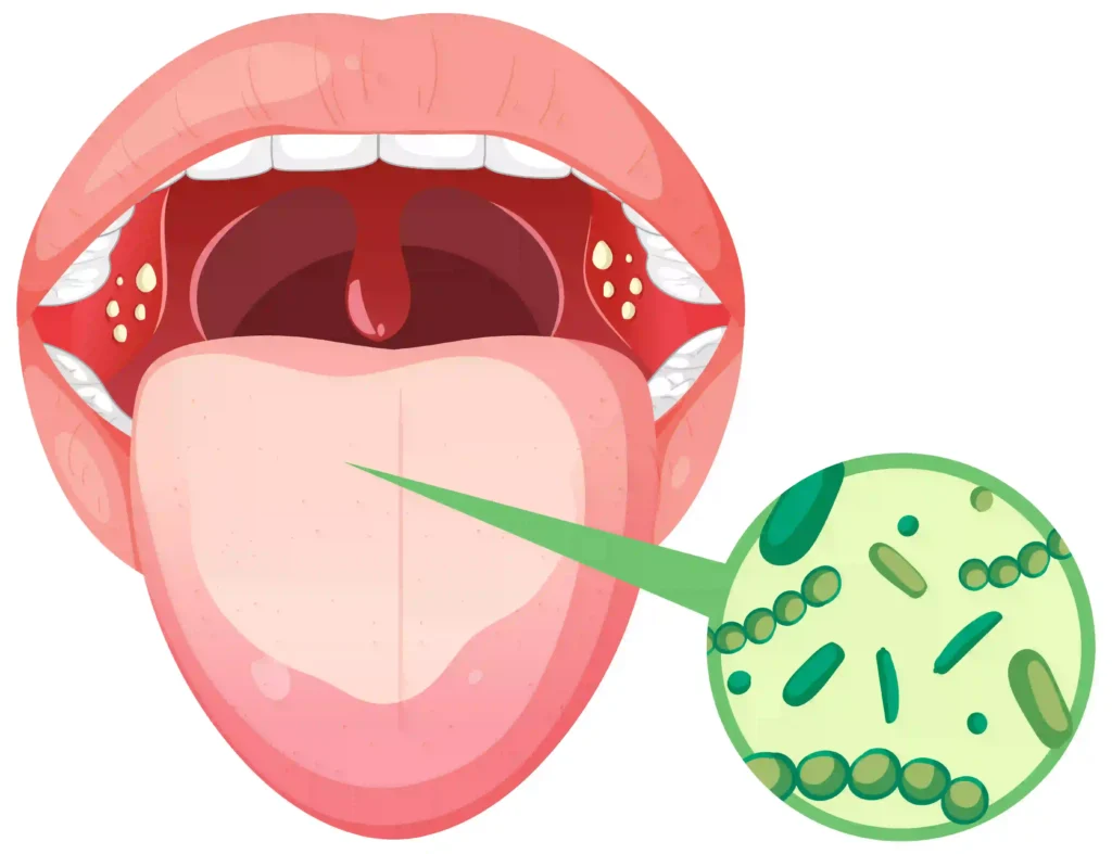 Halitosis: Why Your "Stomach Acid" is Likely an Oral Issue 1 Stomach acid Twinkle Family Dental Care